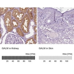 GALM Antibody, Novus Biologicals 0.1mL; Unlabeled:Antibodies, Polyclonal